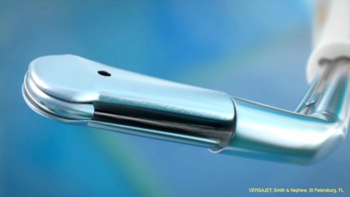 Novel Technique for Colpocleisis: The Use of Tangential Hydro-Surgical ...