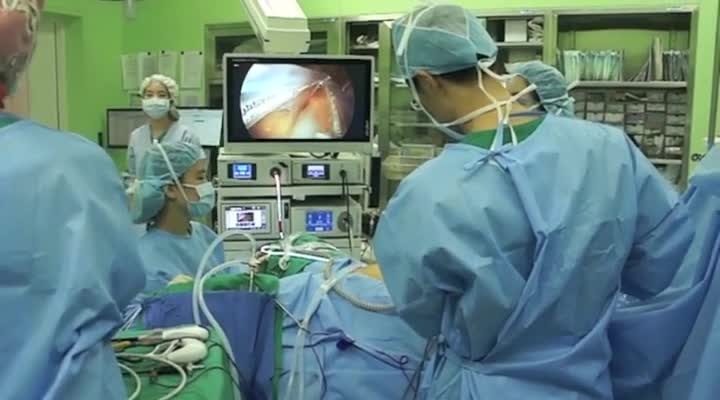 In-Bag Morcellation in LESS Surgery Using a XXL LapBag ® - SurgeryU by AAGL